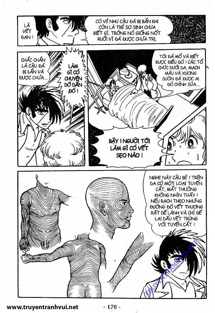 Black Jack Chapter 198 - Trang 2