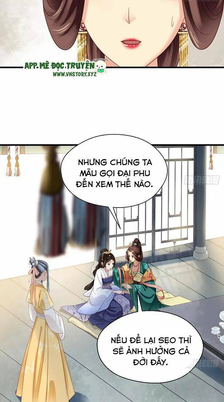 Kiều Nữ Độc Phi Chapter 169 - Trang 2