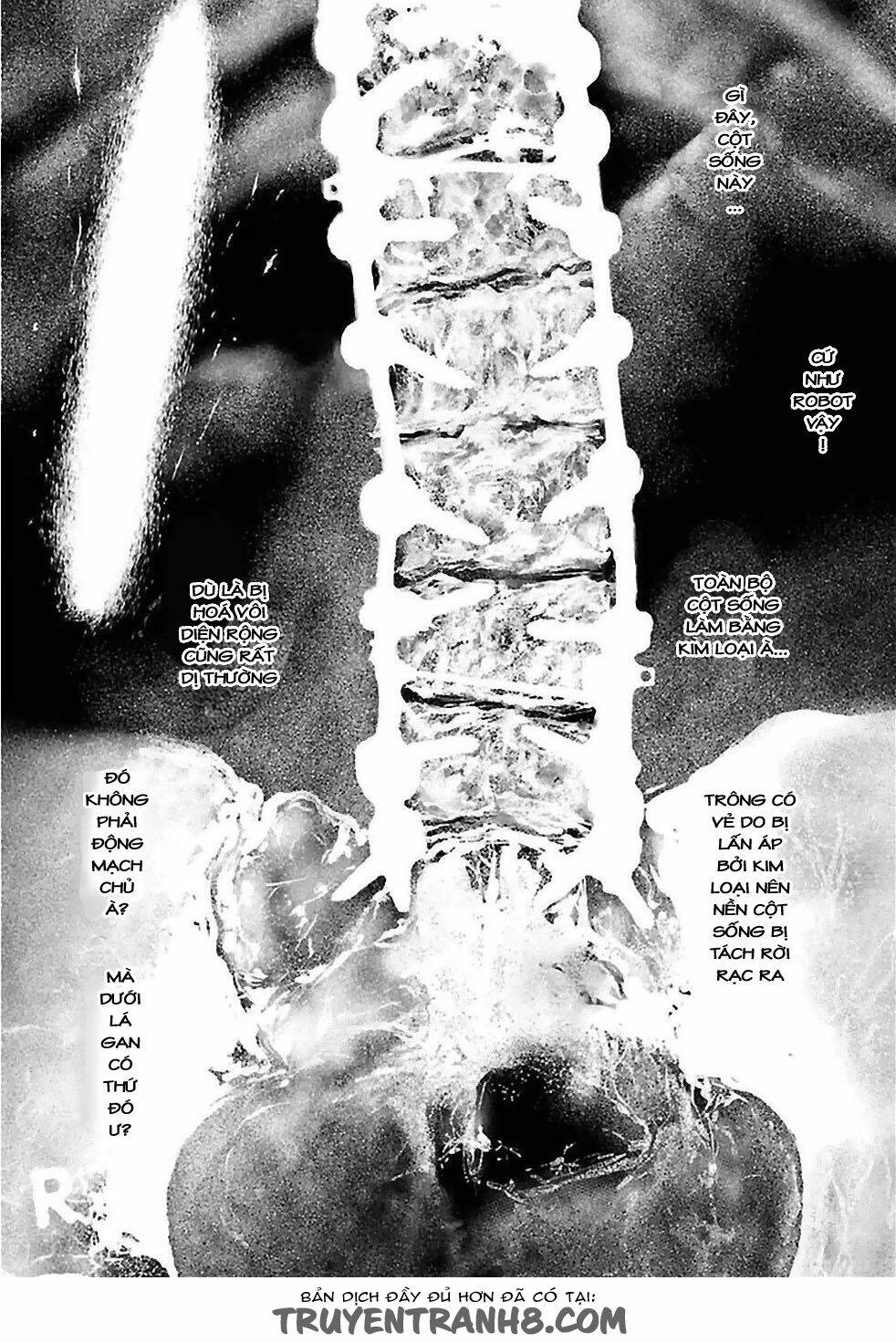 Thời Niên Thiếu Bác Sĩ Quái Dị Chapter 28 - Trang 2