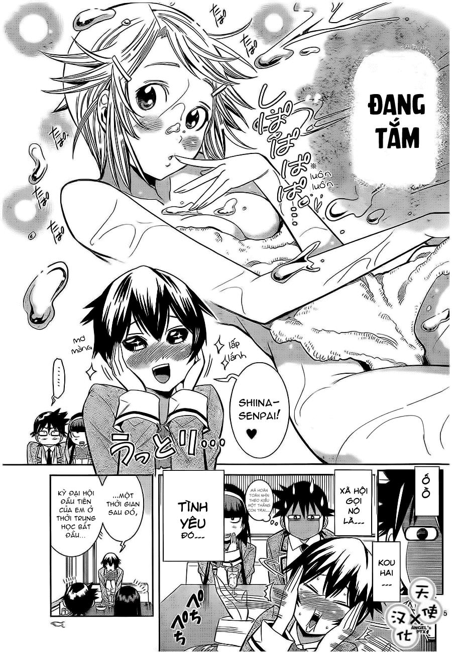 Nozo X Kimi Chapter 22 - Trang 2