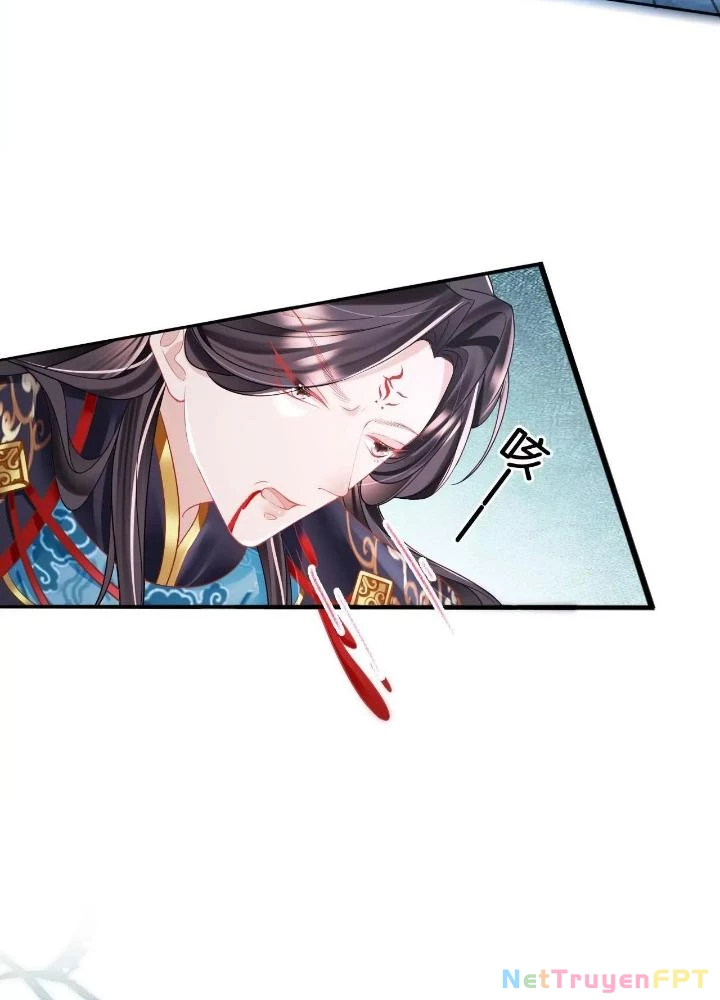 Thiên Hạ Vô Song Chapter 75 - Trang 2