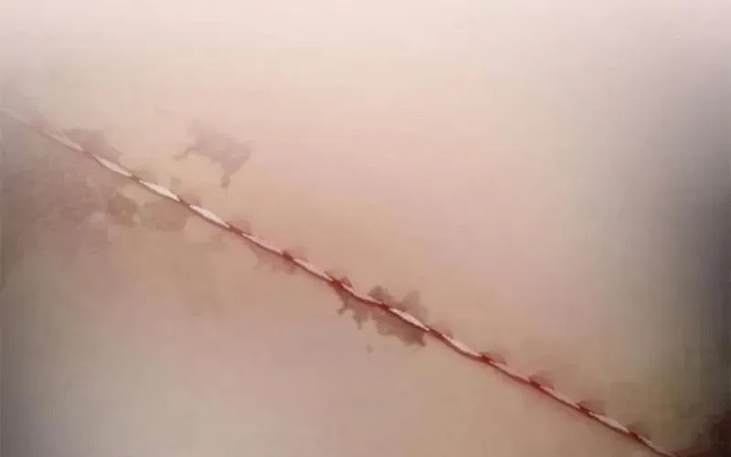 Một Anh Hùng Giỏi Mọi Thứ Chapter 59 - Trang 2